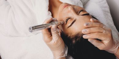 Woman receiving a facial treatment with a microdermabrasion device.