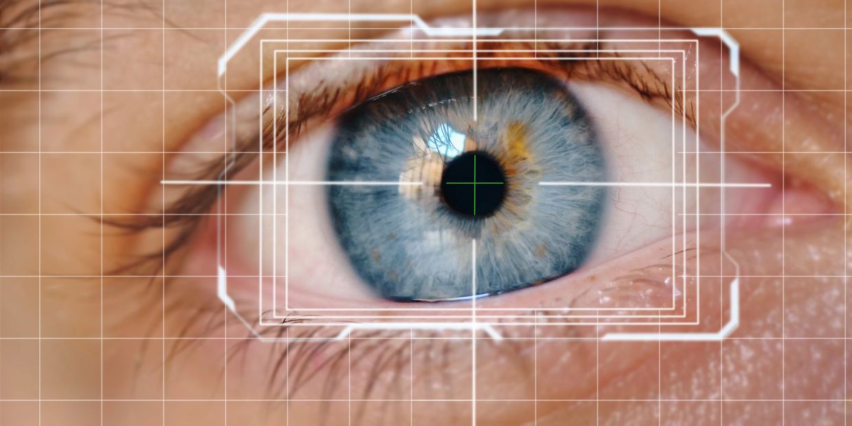 Keratopigmentation Surgery Texas 424-478-9157