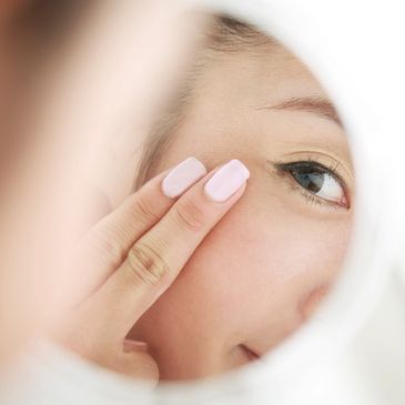 A woman with premature aging skin