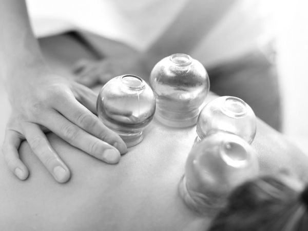 Four glass cups on a person's back during cupping therapy.