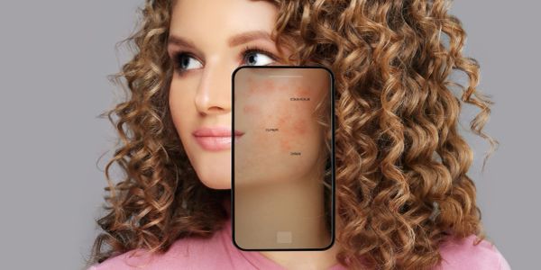 Woman with curly hair holding a phone showing skin issues.