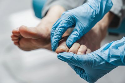 assessment of nails