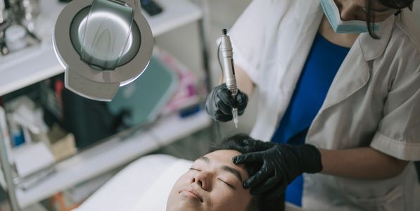 scalp micropigmentation services