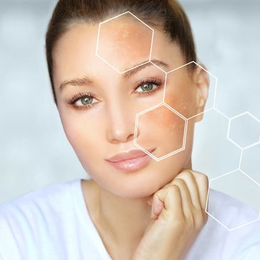 woman with sun damage and age spots treated with IPL Photofacial in Tulsa at Pathway Health & Beauty