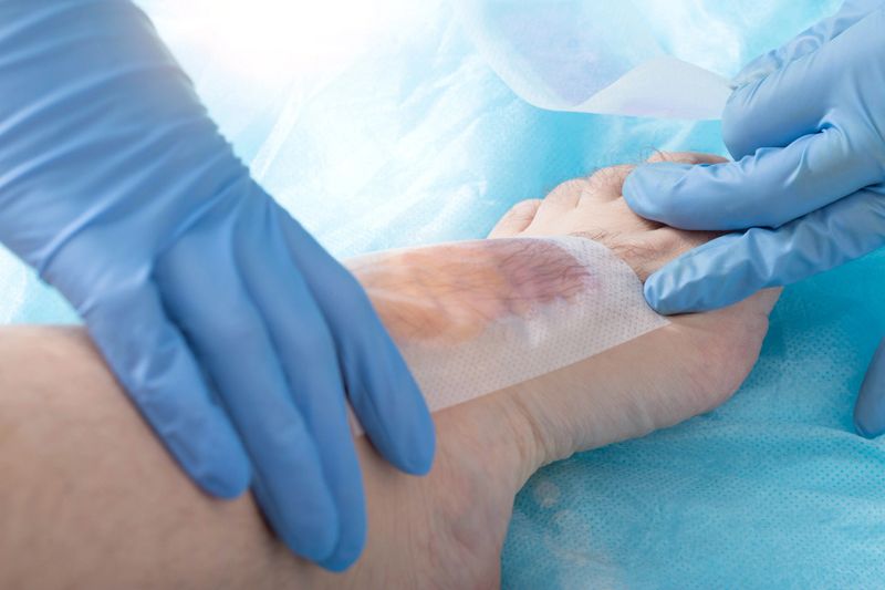 The doctor removes hair from toes with epilating wax strips. Hygiene and cosmetology concept, close-up, bioepilation