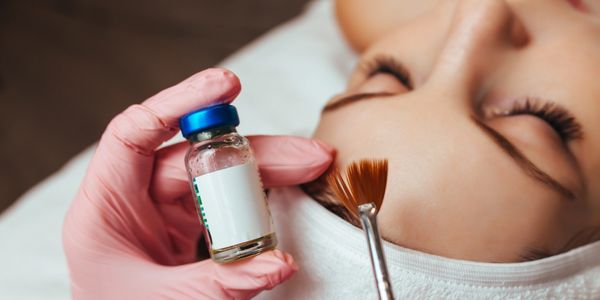 “VI Peel chemical peel treatment at Royal Med Spa & Wellness Goodyear AZ.”