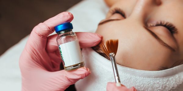 “VI Peel chemical peel treatment at Royal Med Spa & Wellness Goodyear AZ.”
