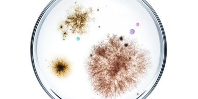 Petri dish with diverse colorful mold colonies growing on agar.