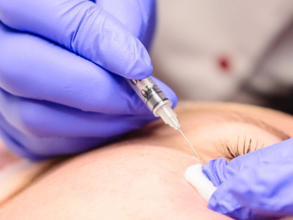 See why Austin & San Antonio clients love Central Texas Botox. Gentle, precise mobile Botox, Xeomin.