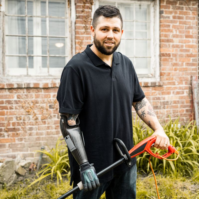 Caucasian Man with disability- prosthetic lower arm  doing garden work in his backyard. He is wearing casual outfit. Exterior of urban backyard of private home.