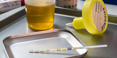 A cannabis drug test kit with a test strip.