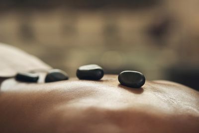 Hot stones placed on a person's back for massage therapy.