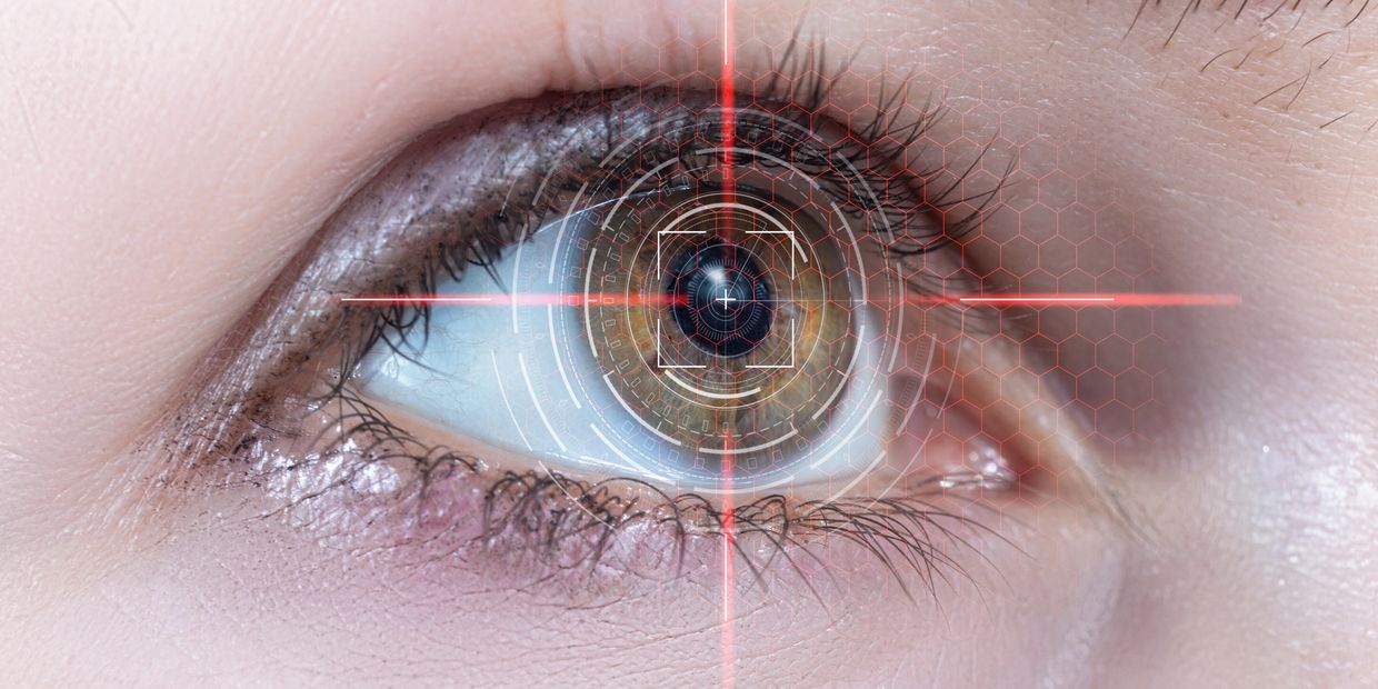 Keratopigmentation Surgery Pennsylvania 424-478-9157