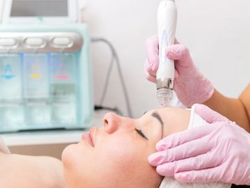 Close up of a Hydrodermabrasion treatment at EyeWows Studio in Temple Terrace, Florida