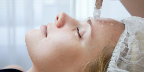 Woman receiving a microneedling facial treatment on her forehead.