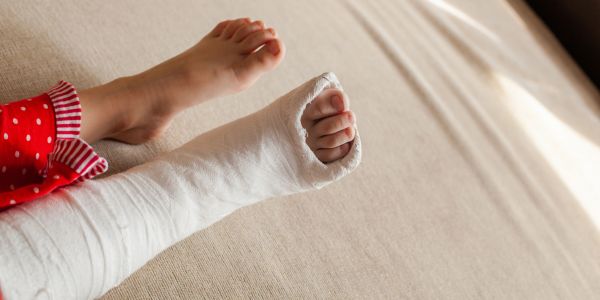 Child with a broken leg in a cast.