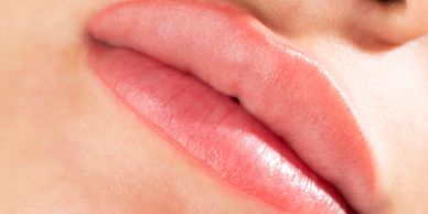 Lip line removal