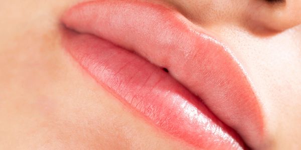 Lip line removal