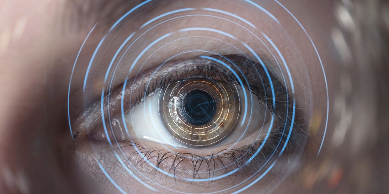 Keratopigmentation Surgery Tennessee 424-478-9157