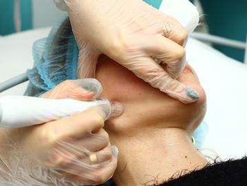 hydrodermabrasion-glow-temple-terrace-fl.jpg