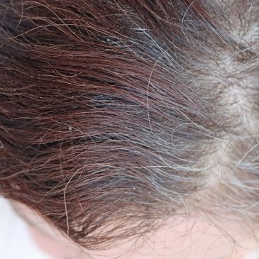 Close-up of brown hair with gray strands.