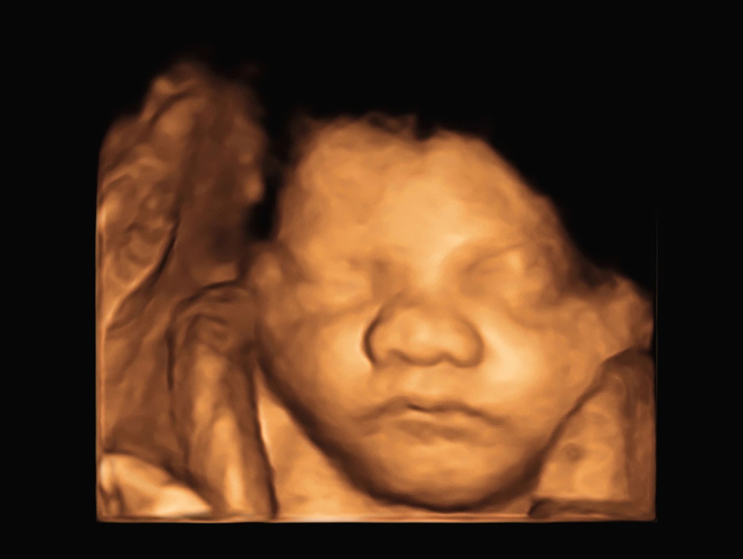 3D Ultrasound | Dothan, AL | Women's Heath & Surgical Services