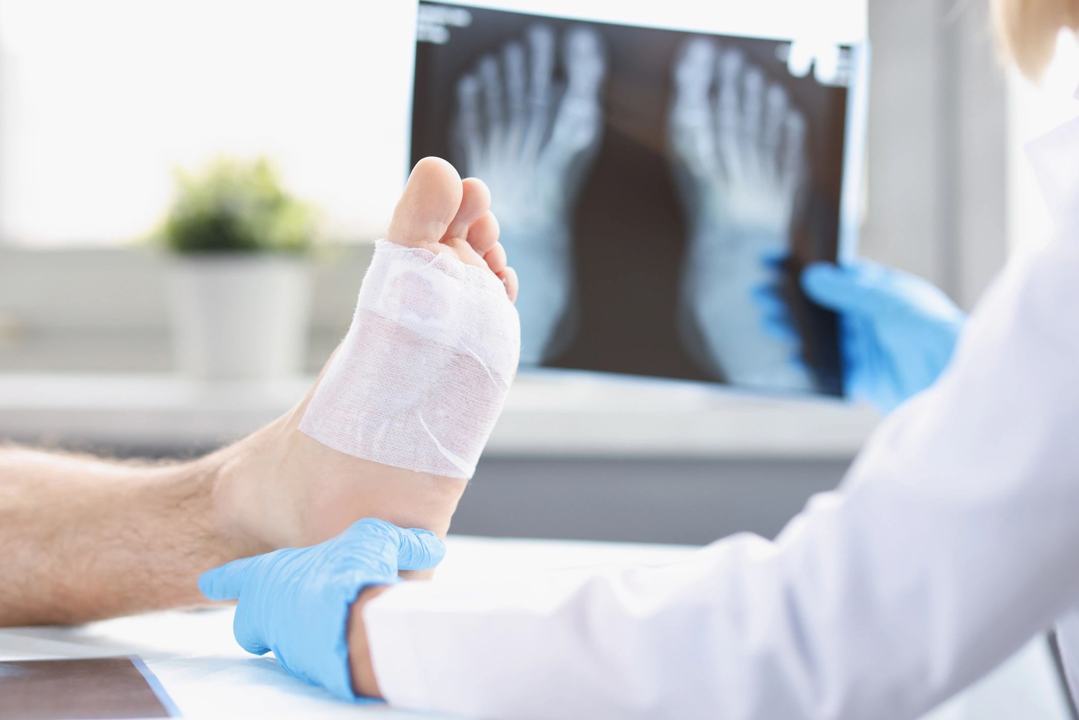 Clinician examining a bandaged foot with foot X-rays visible in the background.