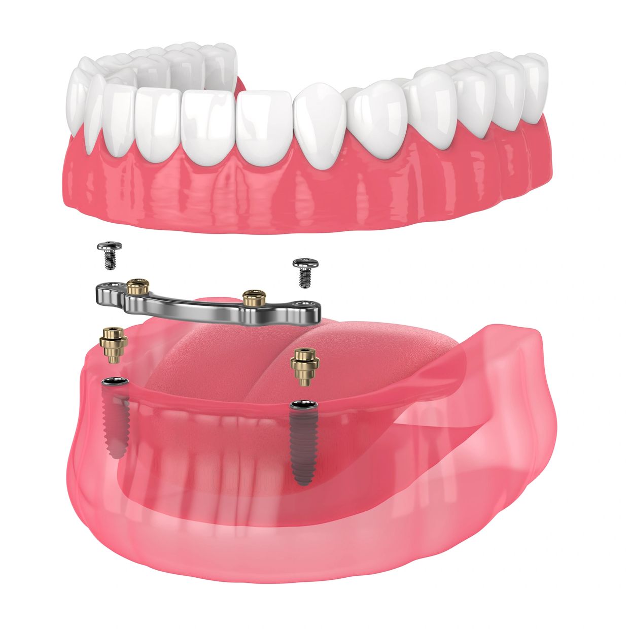 Best dentist in Crossings Republik 