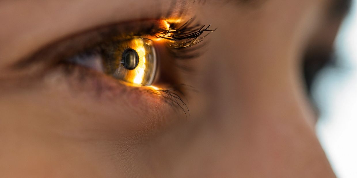 Keratopigmentation Surgery California 424-478-9157