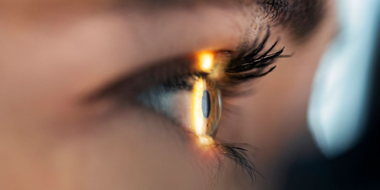 Keratopigmentation Surgery Delaware 424-478-9157