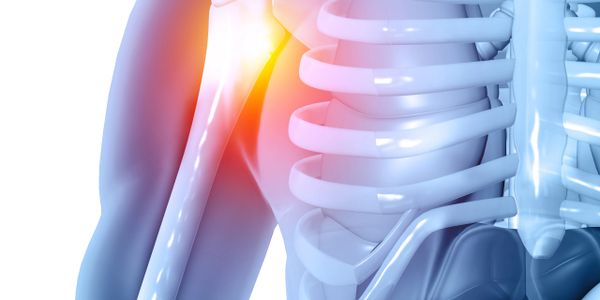 3D illustration of shoulder joint pain highlighted in red.
