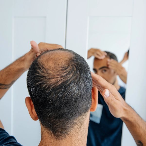 Man checking his balding head in the mirror.