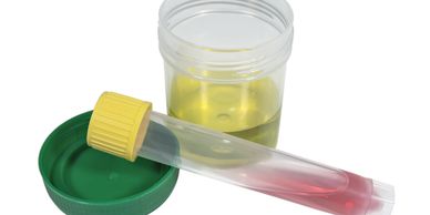 Oral cancer genetic testing with early detection diagnostic support