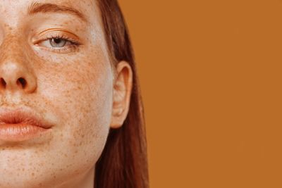 Freckle on a female face