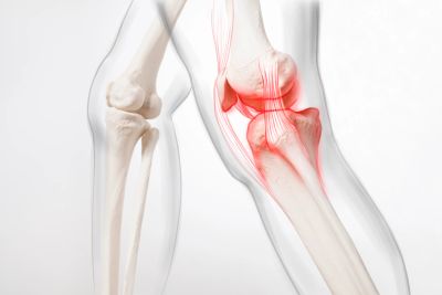 Illustration of knee joint pain and inflammation