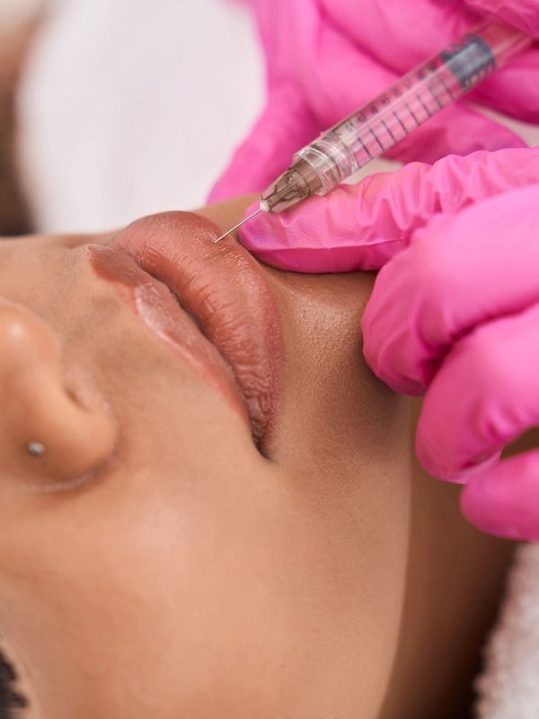 aesthetic nurse injection dermal filler in lips at Royal Med Spa and wellness