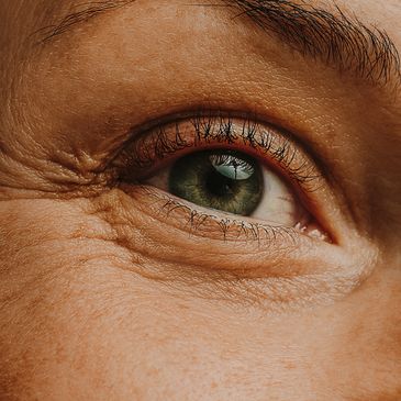 Lady receiving Neurotoxin Xeomin and Letybo for wrinkles in Owasso