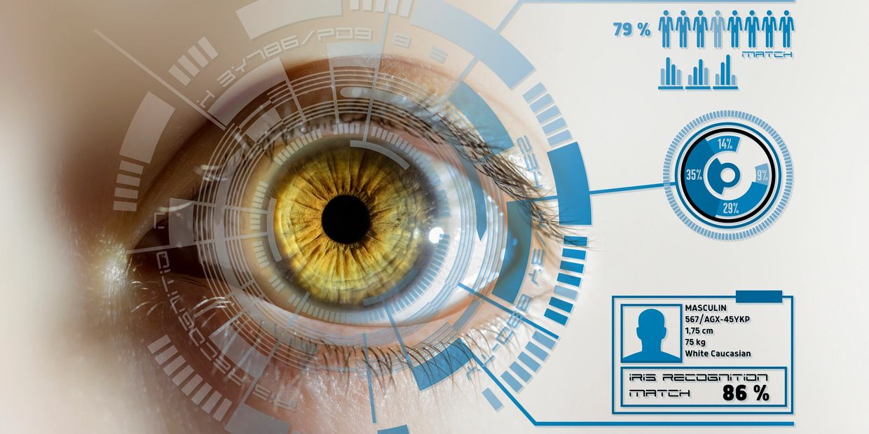 Keratopigmentation Eyes Laser Surgery