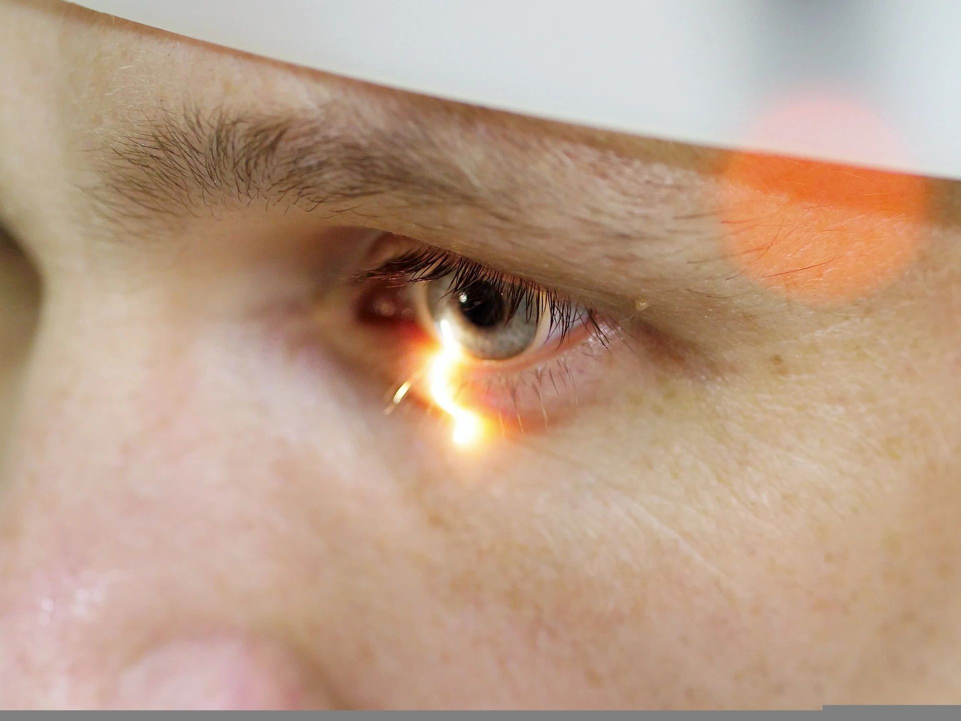 Eye Color Change In Delaware