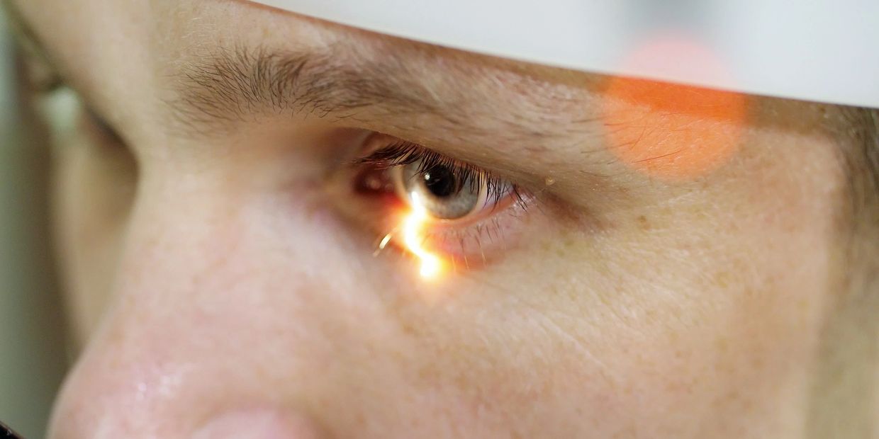 Keratopigmentation Surgery Arizona 424-478-9157