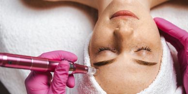Reduce wrinkles, acne scars while improving skin  texture and tone with Microneedling and Ariessence