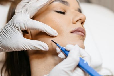 A dermatologist performing a skin treatment on a woman's face.