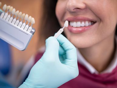 Dentist matching dental veneer shade to a woman's teeth.