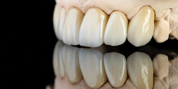 Dental prosthetic model showing artificial teeth against a black background.