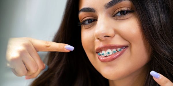 A young woman smiling and pointing to her braces with purple nails.