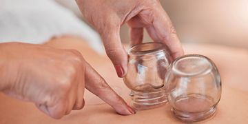 Fire cupping therapy, Encino, California, the valley, 818, 91316, holistic healing, wellness
