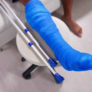 Person with a blue leg cast and crutches beside a stool.