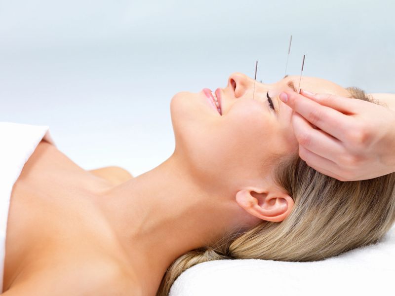 Beautiful young woman with eyes closed receiving Acupuncture therapy