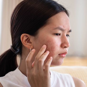  A woman with persistent irritaion and redness