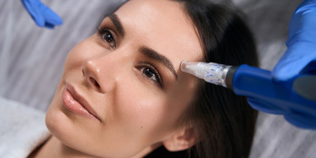 Microneedling